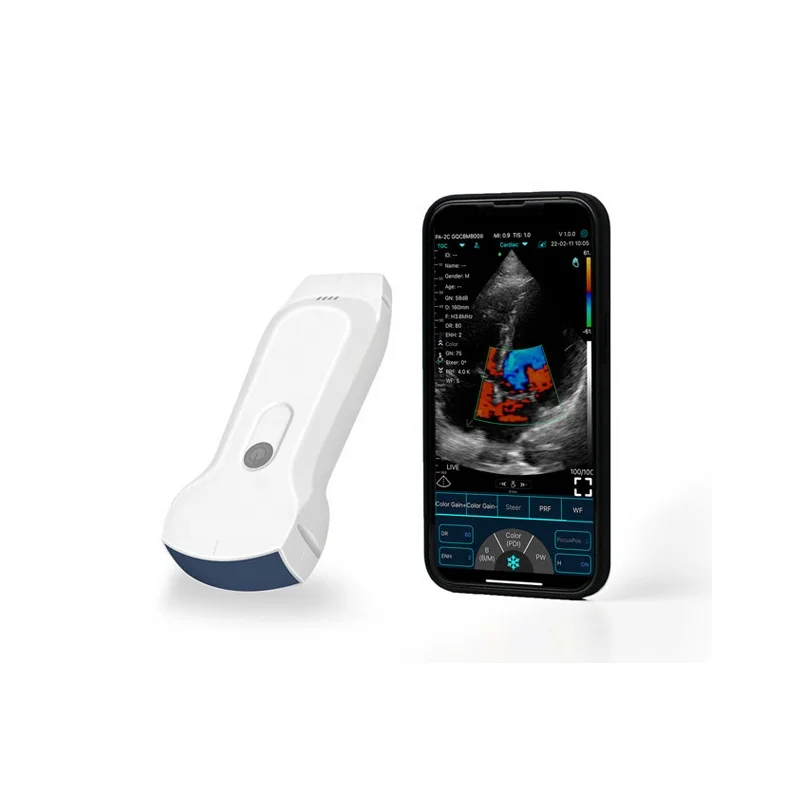 Medical Ultrasound Instruments Usg Portable Wireless Probe Electric Plastic Ce Color Doppler Ultrasound Price 256 Level Class II
