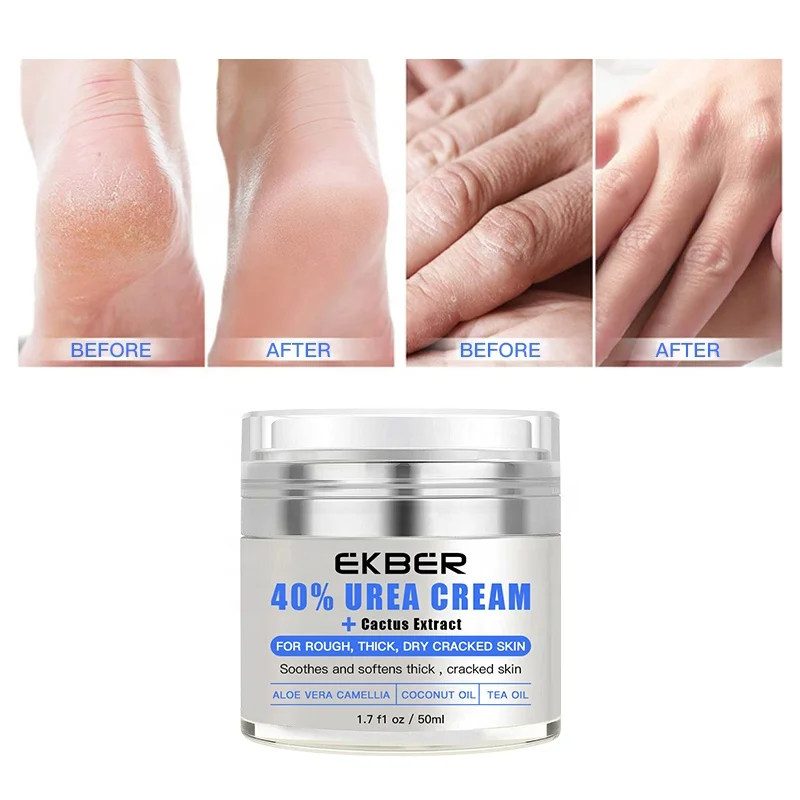 Private Label OEM Face Cream With Urea For Dry Skin Urea 40% Cream Moisturizer Whitening Vitamin E Lotion For Black Skin
