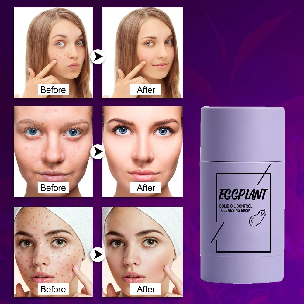 4 pcs clay Green Tea Mask Stick Blackhead Remover charcoal stick mask Deep Pore Cleansing  Skin Brightening orange mask stick