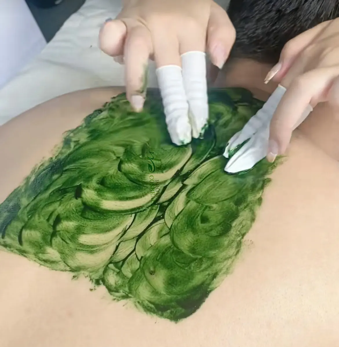 Natural Kr algae peeling for aesthetics rejuvenation Clinic