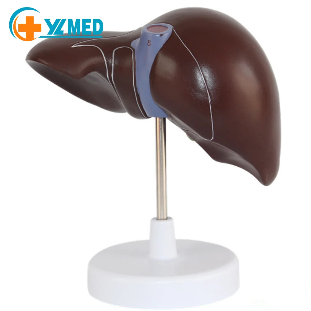 Medical Supplies Human Teaching Liver Pathological Model For School Medical Teaching Display Tool Lab Equipment