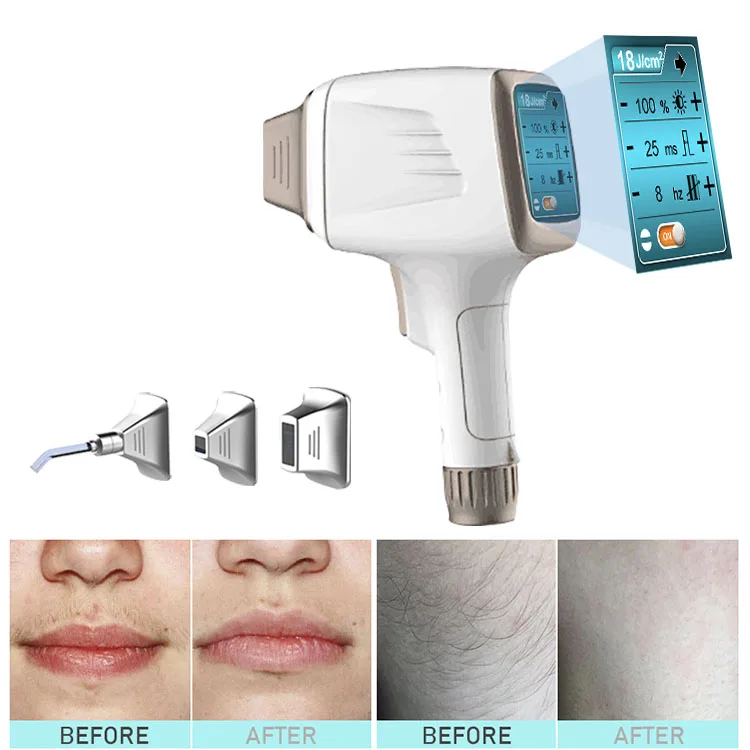 Intelligent diode laser with screen in the handle TEC cooling+ IPL skin rejuvenation 2 in 1 machine