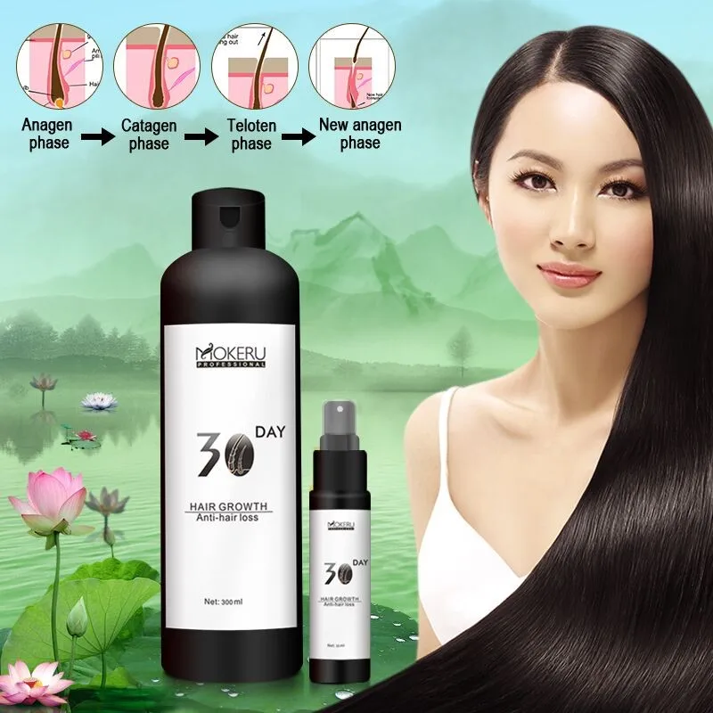 Guangzhou professional hair loss or drop treatment and effective repair specifically for bald or about to be bald people