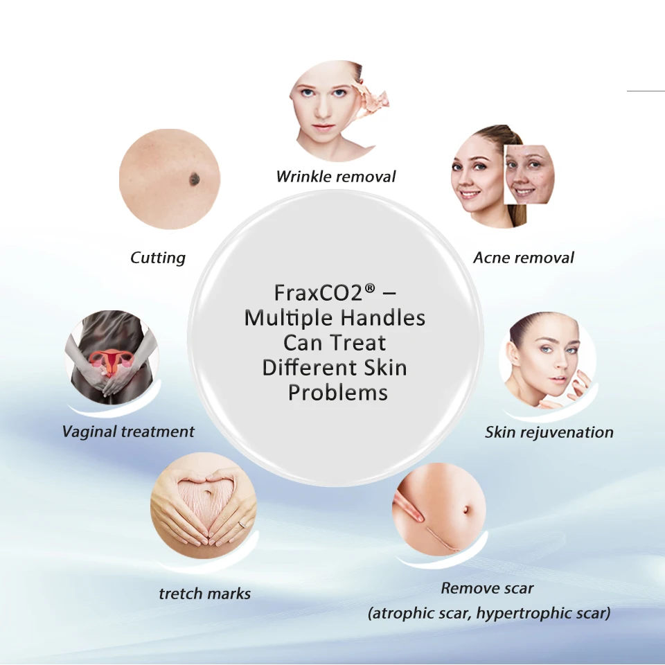 Fractional Rf Tube Laser Machine Vaginal Co2 Laser Fractional for Medical Clinic