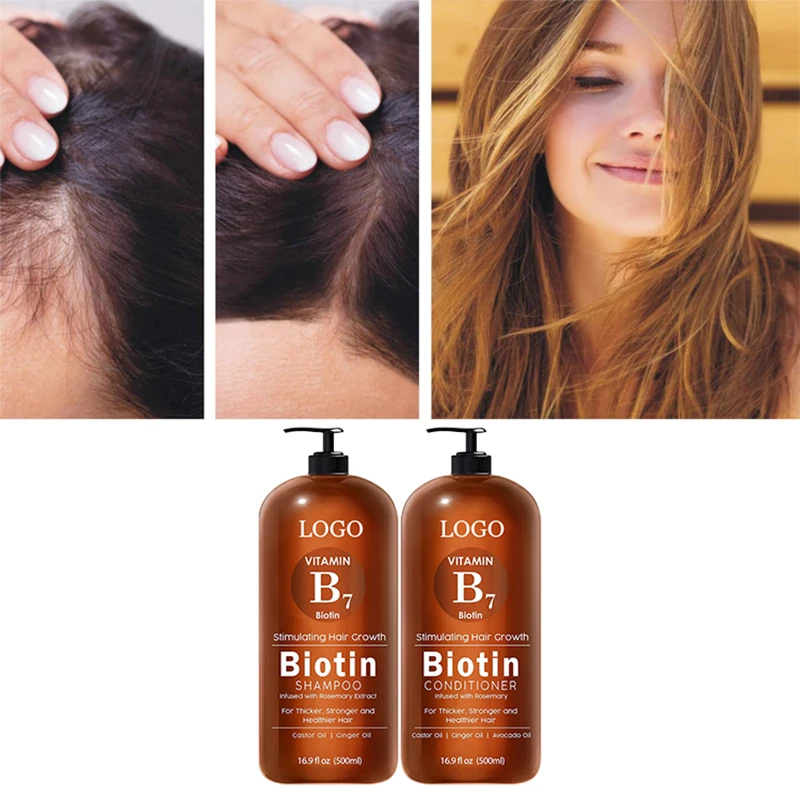 Private Label Prevents Hair Loss & Promotes Healthy Hair Care OEM Hair Growth Shampoo and Conditioner Set