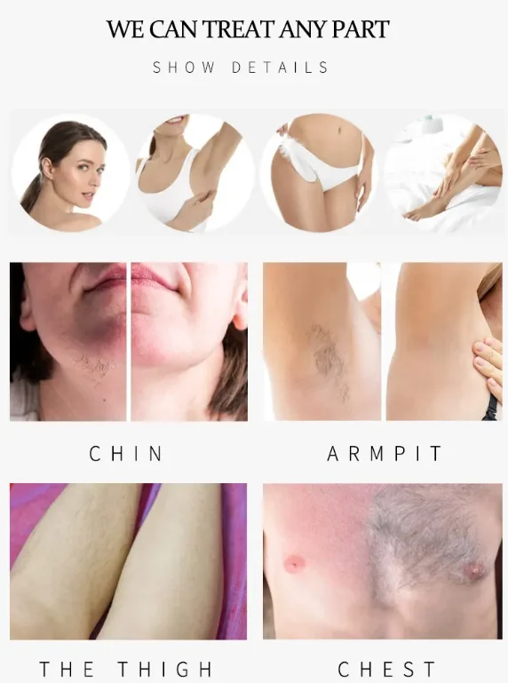 2400w 4k display beauty personal care products 3 wave diode 808nm hair removal machine beauty salon equipment laser hair removal