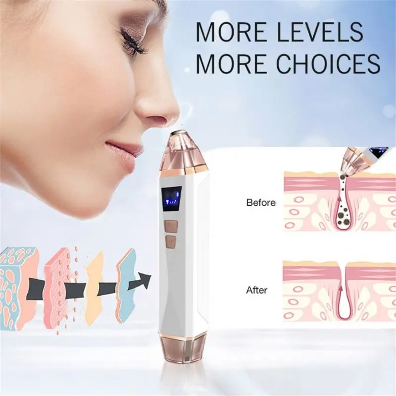 Facial Deep Cleaning Machine Whitehead Acne Treatment Pore Vacuum Blackhead Remover