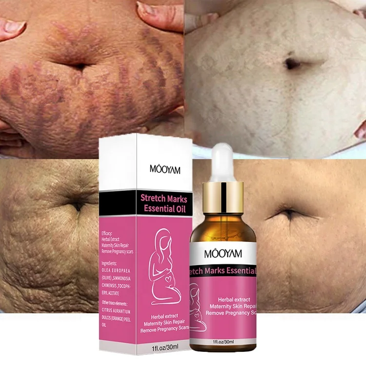 OEM Strong Repairing Pregnancy Marks Oil Growth Acne Scars Removal Oil Stretch Mark Removal Oil