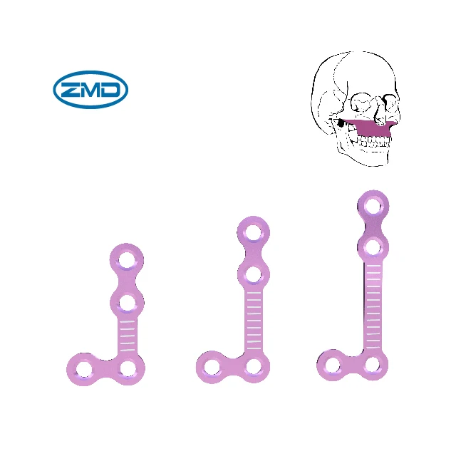 Orthopedic Maxillofacial 1.5 Self-drilling Screw