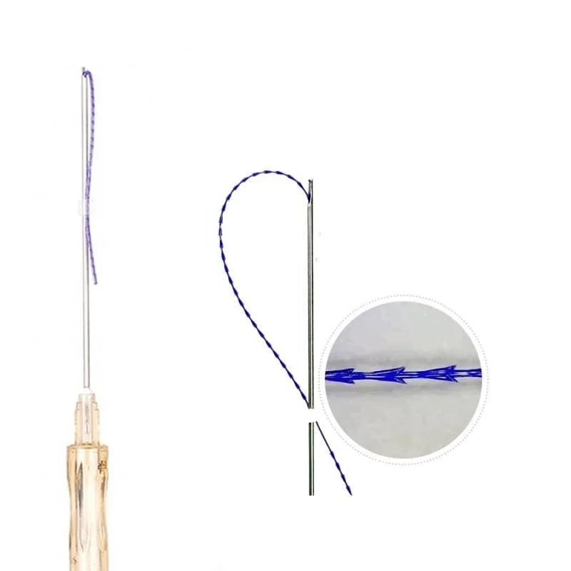 Barbed Suture Eye Brows Lifting Remove Double Chin Double Needle Pdo Threads 20g 100mm 450mm