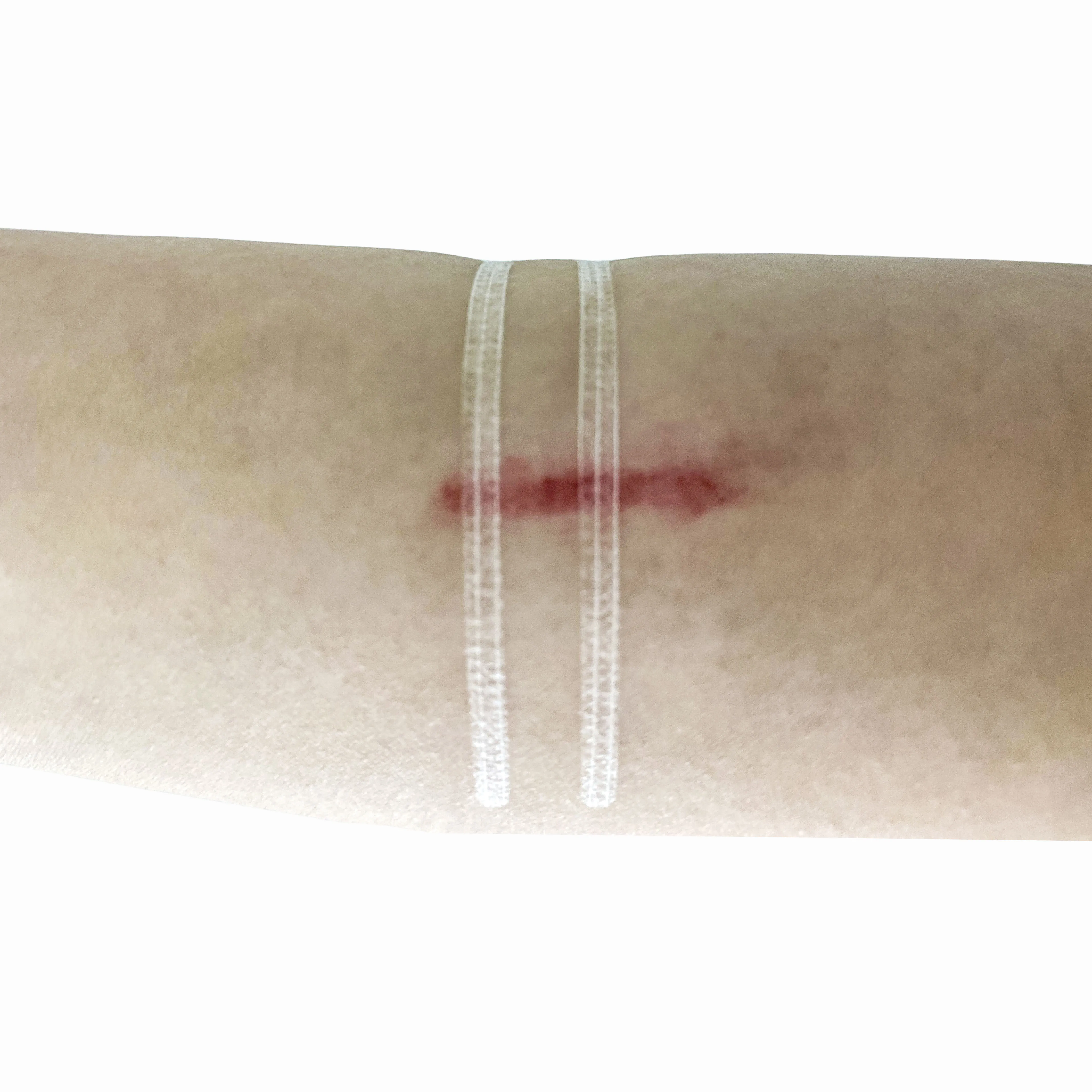 breathable non-invasive zipper wound skin closure strip