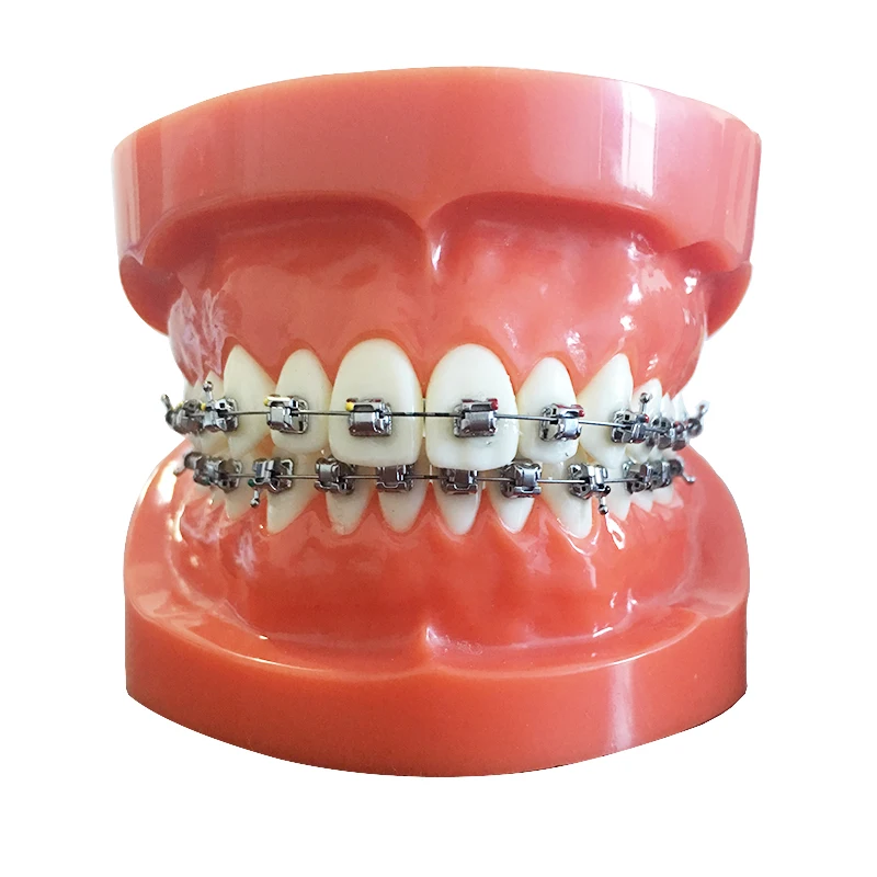 Manufacturer Orthoontic Metal Roth Passive Self Ligating Orthodontic Brackets Orthodontic Braces