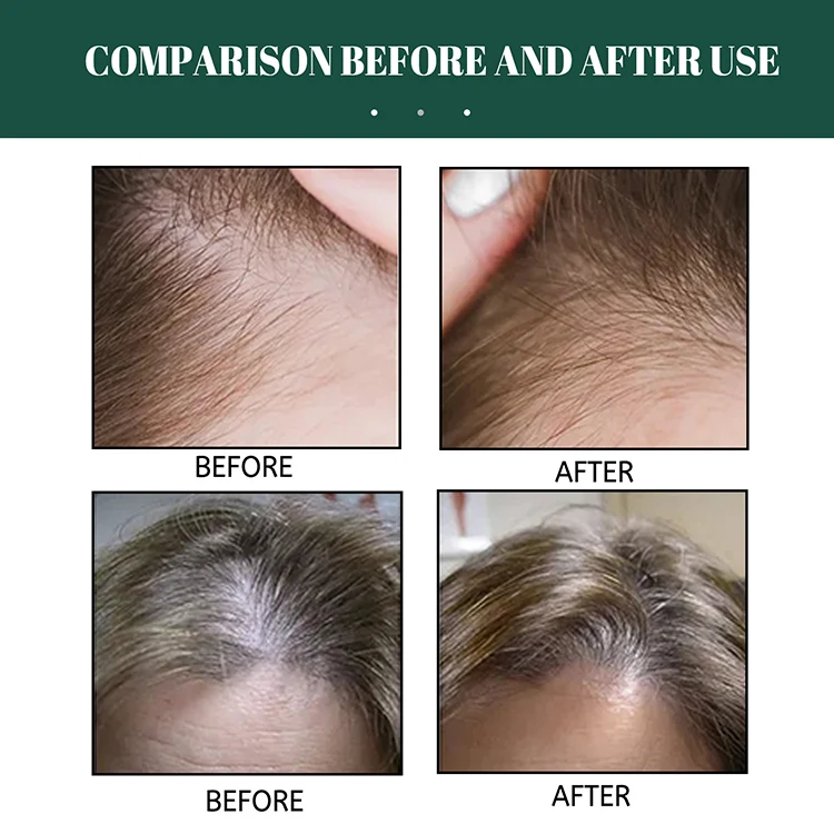 Wholesale Organic Natural Ginseng Hair Growth Serum Spray 30ML Fast Hair Function Growth Serum for Loss Prevention