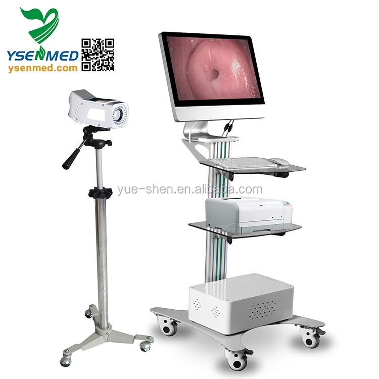 YSSW3304 Ysenemd HD Specialized Digital Optical colposcope workstation mobile colposcope 4k colposcope for gynecology trolley