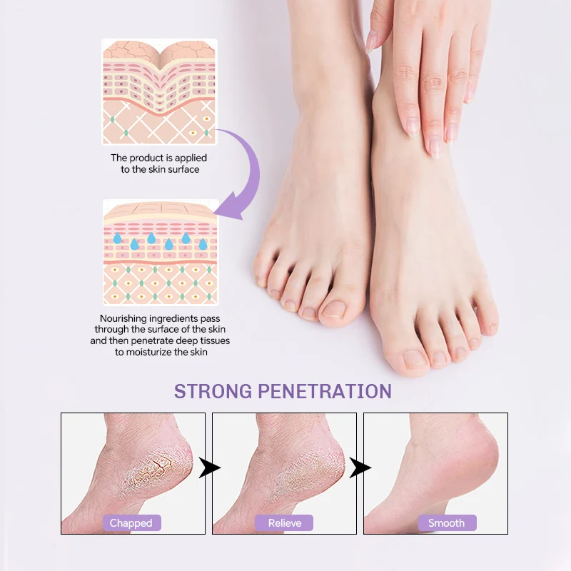 Moisturizing Foot Cream, Dry & Cracked Skin on Heels and Feet Foot and Heel Balm