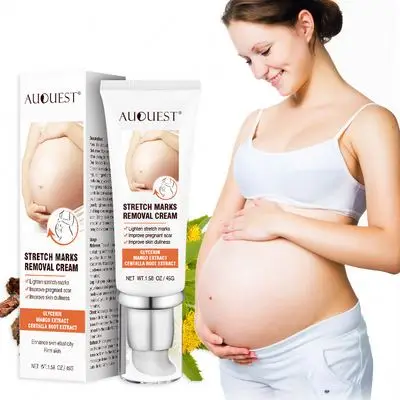 Auquest Improve Pregnant Scar Mango Extract Stretch Marks Removal Pregnancy Body Cream 45ml