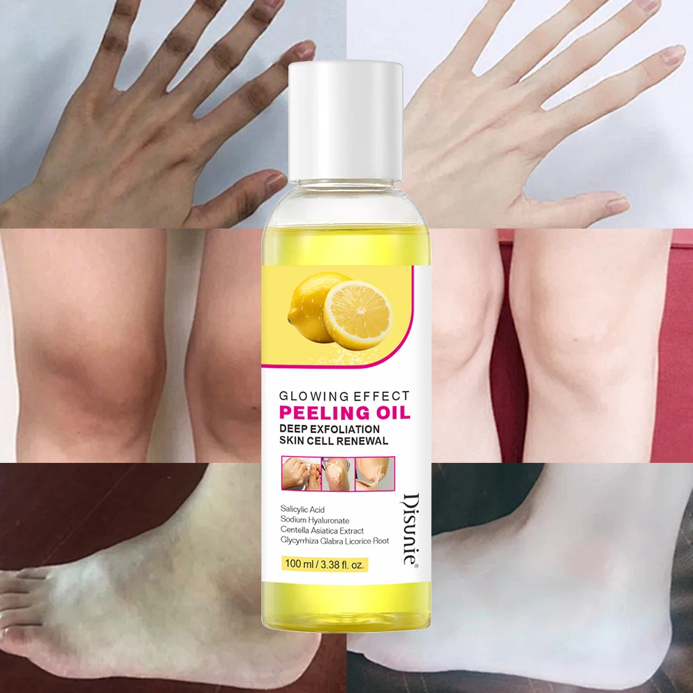 New Lemon Brighten Peeling Oil Gel Salicylic Acid Deep Exfoliation Skin Renewal Removes Dead Skin Peeling Glowing Skin Products
