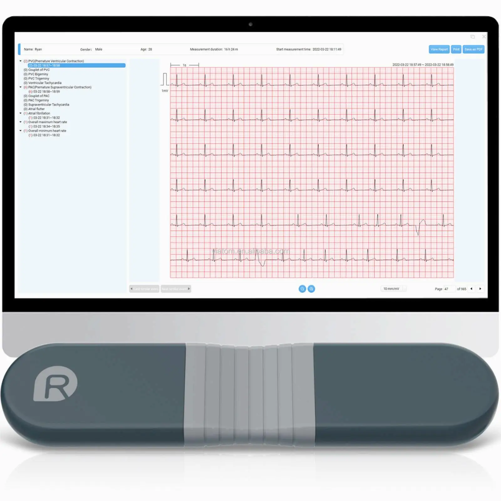 Medical ECG Patch Real-time Dynamic ECG Recorder Wireless Bluetooth ECG Holter