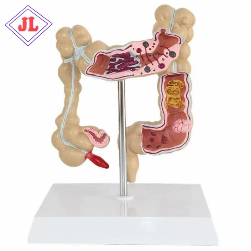 Advanced Medical Supplies Human Teaching Large Intestine Anatomy Model For School and hospital