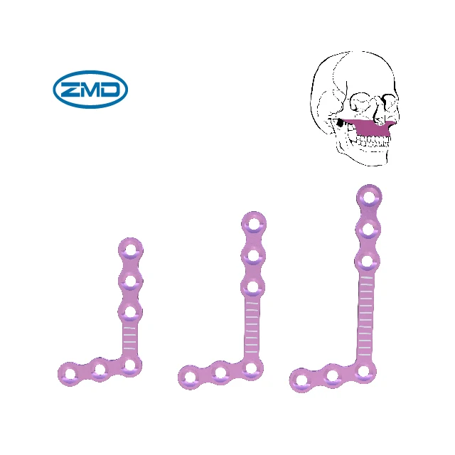 Orthopedic Maxillofacial 1.5 Self-drilling Screw