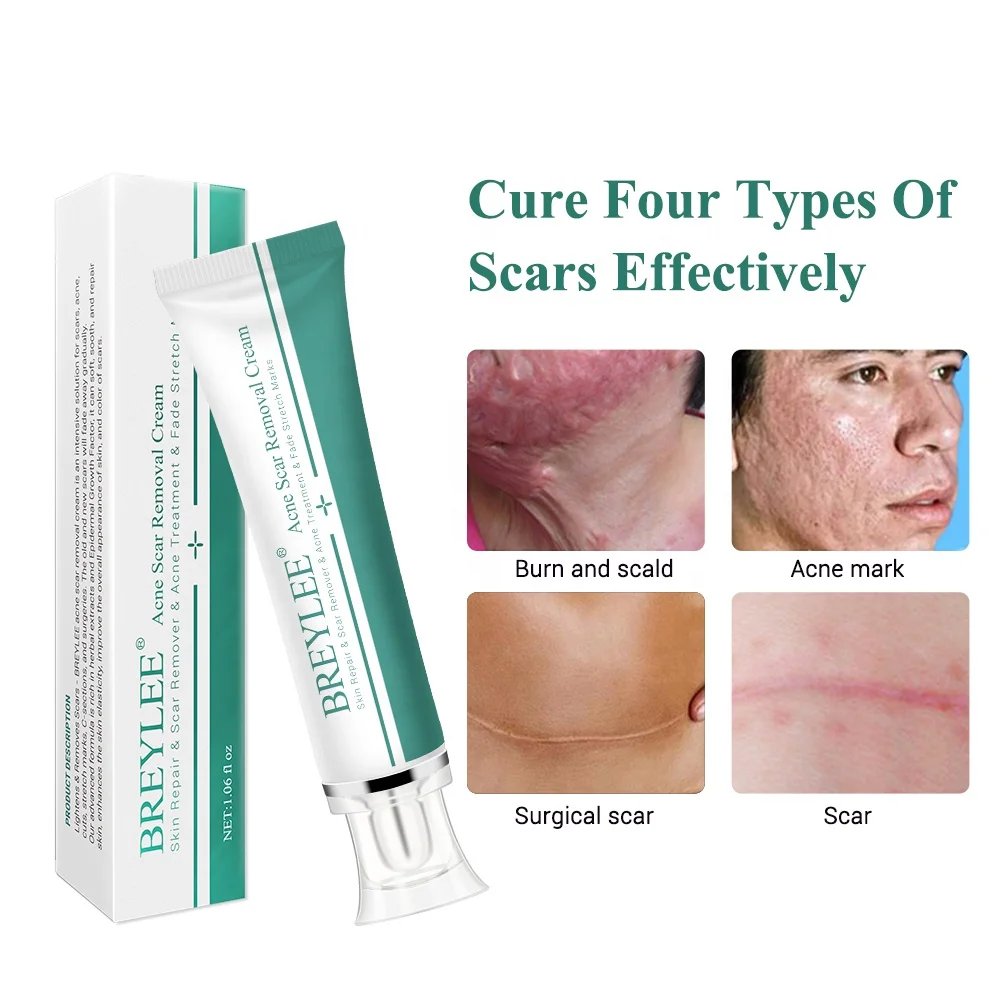 BREYLEE Natural Acne Treatment Skin Repair Stretch Marks Removal Acne Scar Removal Cream