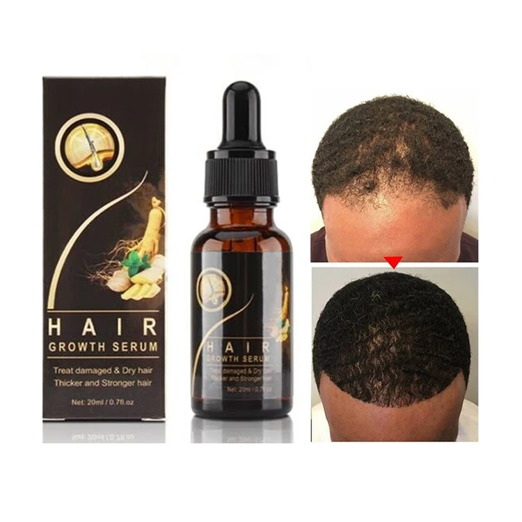 Тоник для волос от частной марки, натуральная формула, питательный эликсир для кожи головы, уход за волосами, лечение выпадения, масло для роста волос, сыворотка