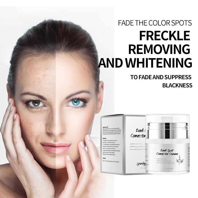 Best chinese black skin skin whitening Freckle creams without side effects whitening cream for face
