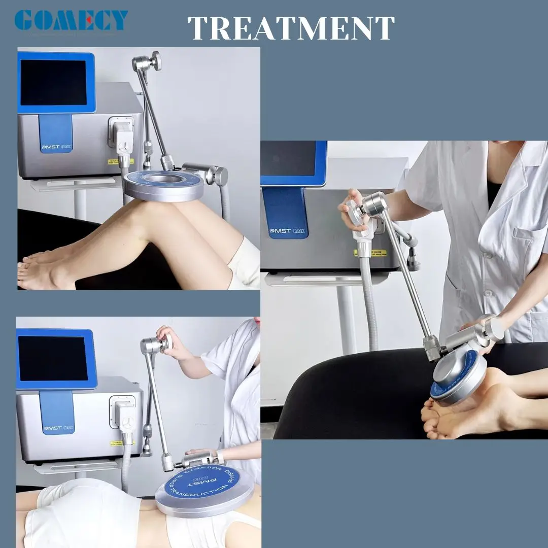 GOMECY Physio Magneto PMST MAX ИМПУЛЬСНЫЙ аппарат для электромагнитного поля обезболивающий PEMF