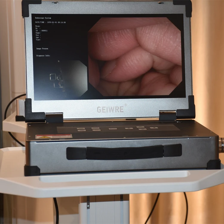 Portable USB/Tap C Endoscope System Electric Medical Equipment Video Ureteroscope for Surgical Instruments