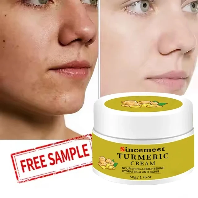 OEM Face Cream Care Removing Dark Spots Acne Treatment Anti Acne Face Vitamin C Cream Turmeric Cream