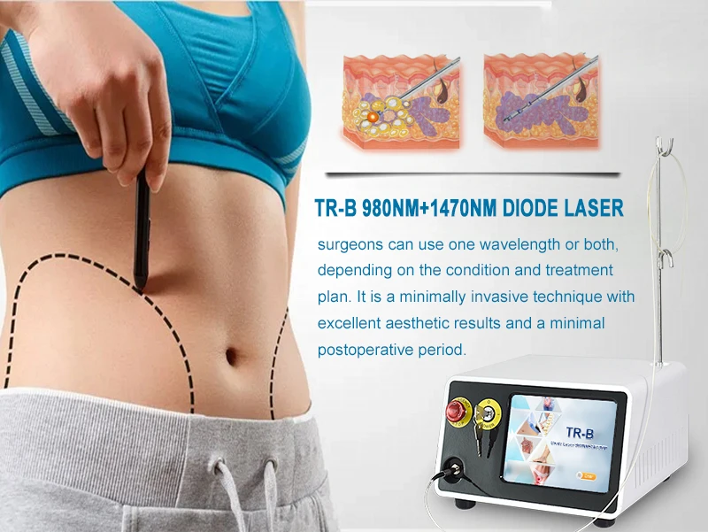2023 laser assisted lipolysis 980nm+1470nm doctors laser double chin machine vaser liposuction machine clinic