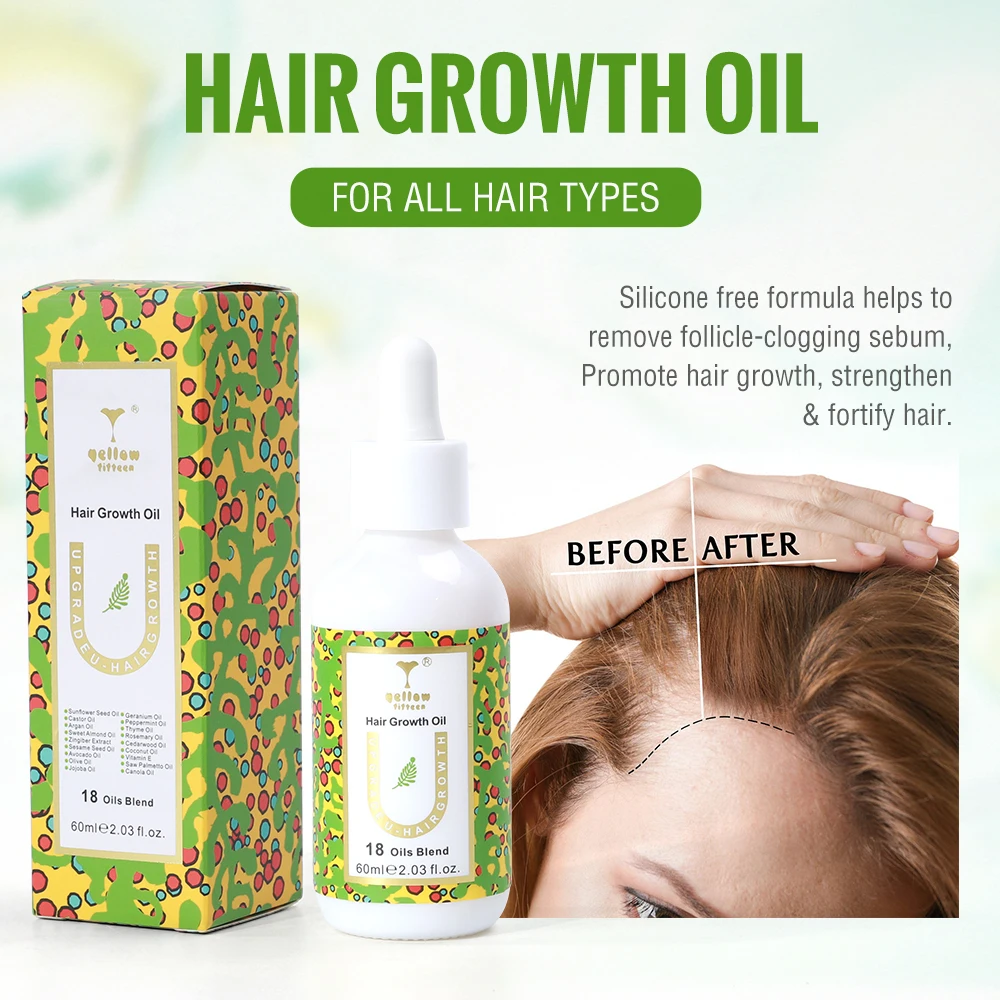 Factory Price Private Label Rosemary And Avocado Hair Growth Oil Serum Natural Fast Hair Growing Castor Oils for Hair Growth