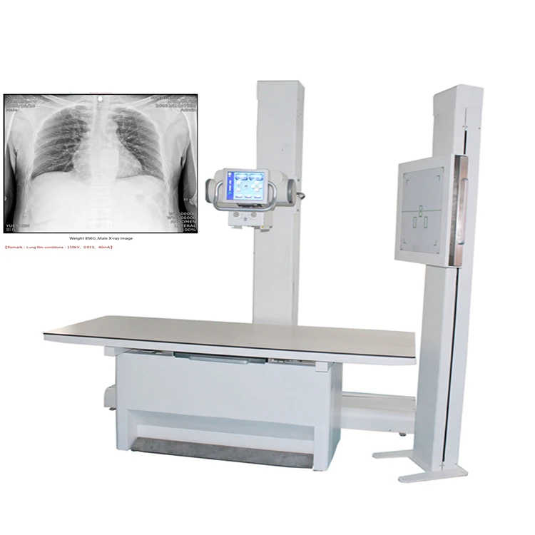 2020 Yueshen  Automatic  32kw KV Range 40 to125KV  Digital High Frequency X-Ray Equipment  x ray Machine 500 ma System