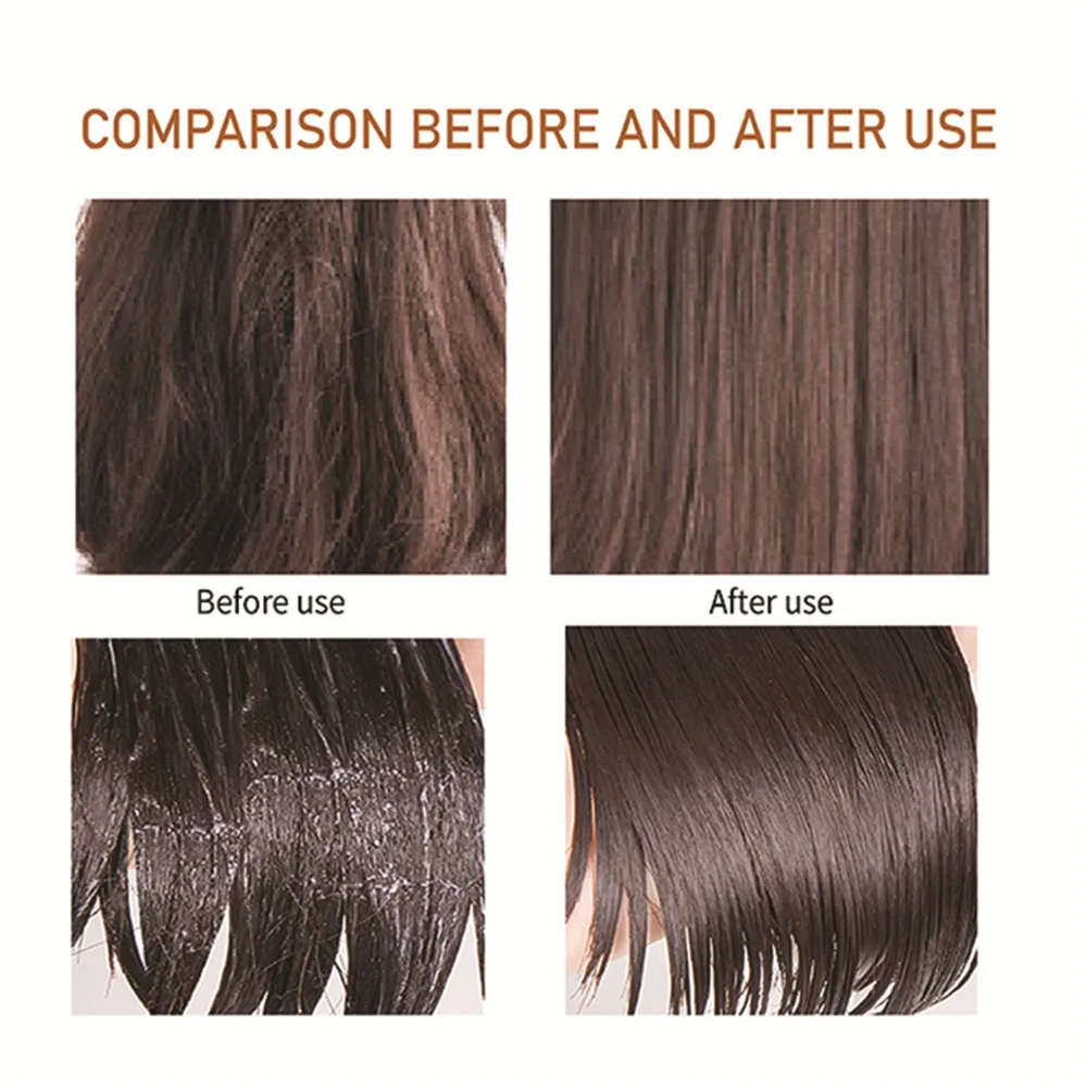 
Dry Shampoo Wholesale Organic All Natural Anti-Itching Shampoo Biotin Dandruff Shampoo Dry Shampoo Wholesale Organic All Natural Anti-Itching Shampoo Biotin Dandruff Shampoo