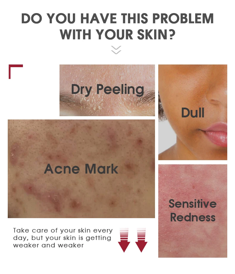 Skin Toner Bulk Silicone-Free Skin revitalizer Anti-wrinkle and Hyaluronic acid Vitamin C AHA Rose Water Toner Daily Spray Face