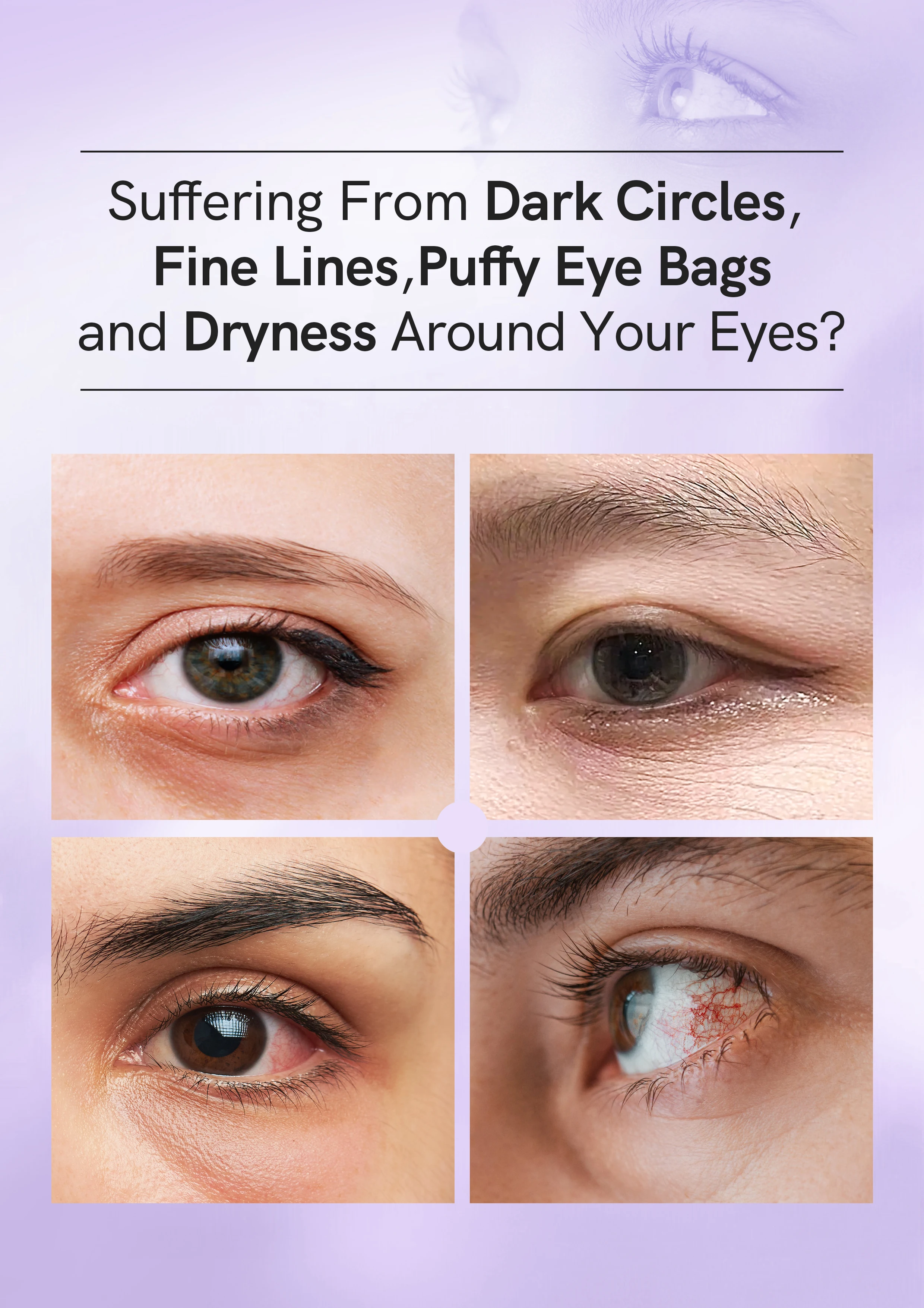 Wholesale Increase Hydrating Reduce Wrinkles Improve Dark Circles Eye Mask Niacinamide Hyaluronic Acid Eye Mask Patches