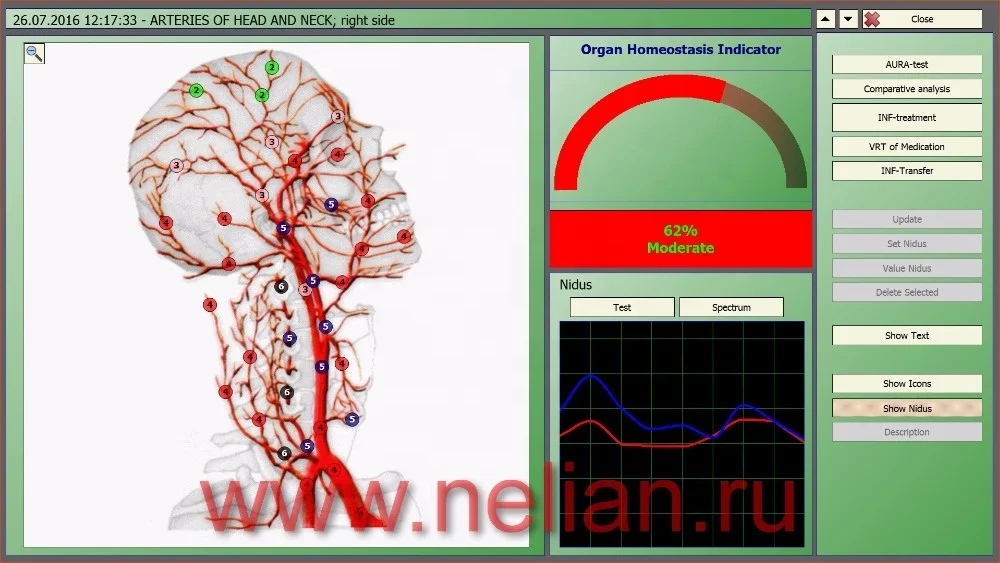 Biolazer-Oberon Dianel-5122 biofeedback diagnostic health scanner with cell test for homeopath professional holistic use