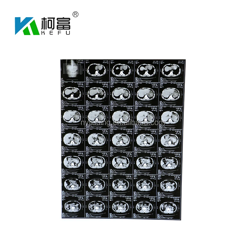 Medical X-Ray Film for Fuji Drypix 2000 fuji 3500 printer