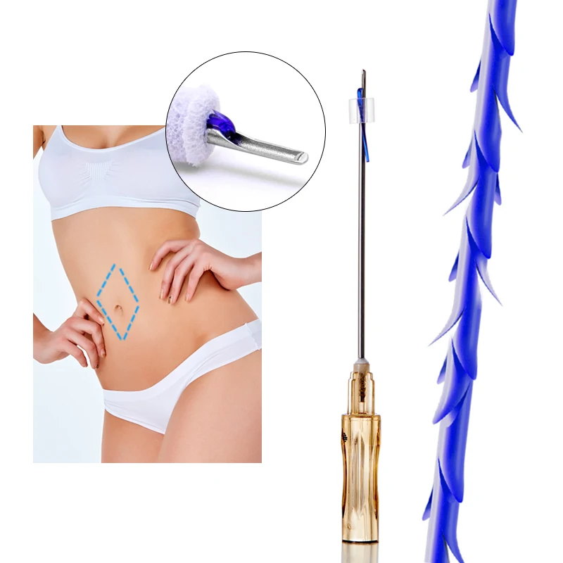 High quality korea hilos tensores para el rostro w canula cog 19g 100mm barbs lifting pdo thread for face lift