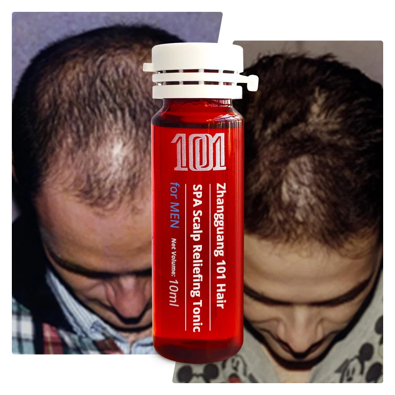 Private Label Herbal Extracts Ampoule Hair Care Treatment Serum for Men