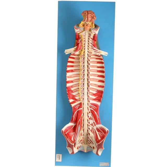 GD/A18102 Spinal Cord in the Spinal Canal(medical model, anatomical model)