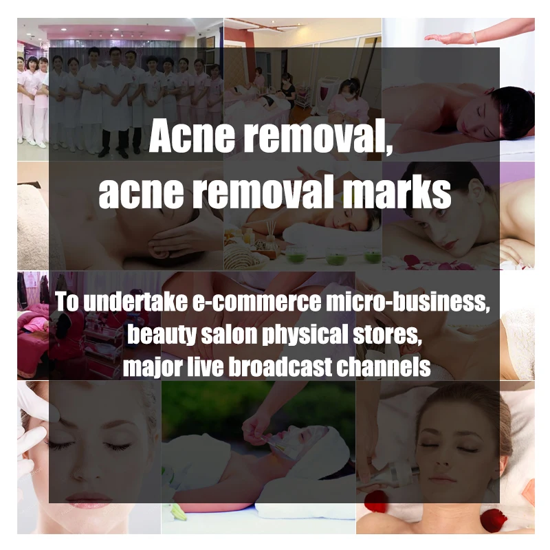 
OEM/ODM Custom pure natural herbal plant remove freckles remove dark spots whiten facial skin mask 