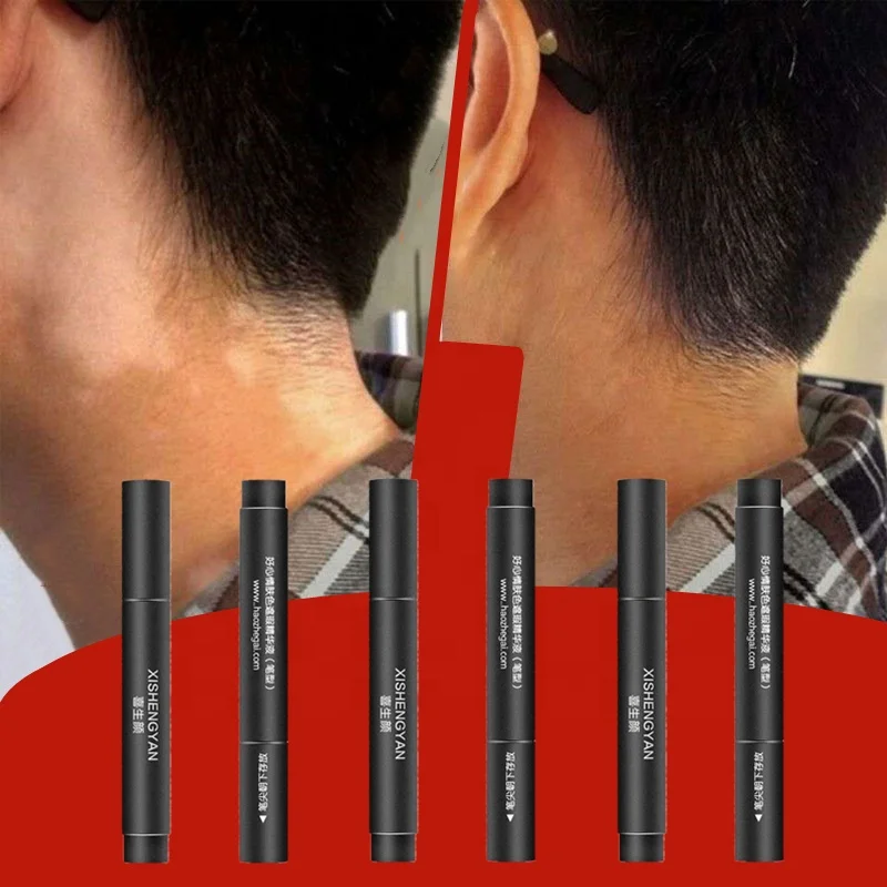 Retail Face Body White Spot Cosmetic Cream Pen Lasting Patches Makeup Waterproof Cover Concealer Vitiligo for Women Men