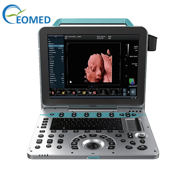 EO-P50 High quality Portable Color Ultrasonic Diagnostic Apparatus with 15 inch High Definition Medical LED display