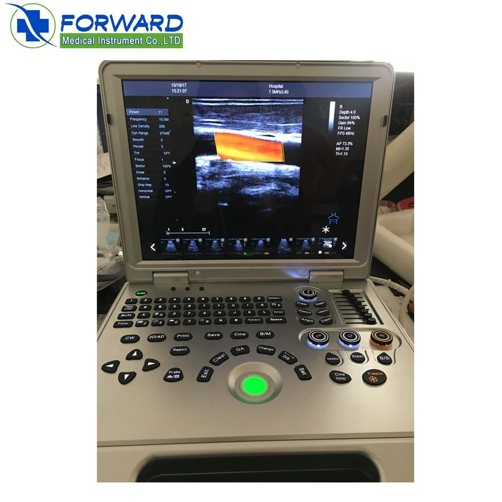 4D laptop portable color doppler ultrasound machine for human