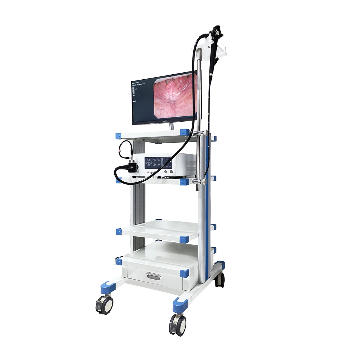 Digital Endoscope System Machine Gastroscope and Colonoscopy with Anesthesia for Trolley Camera