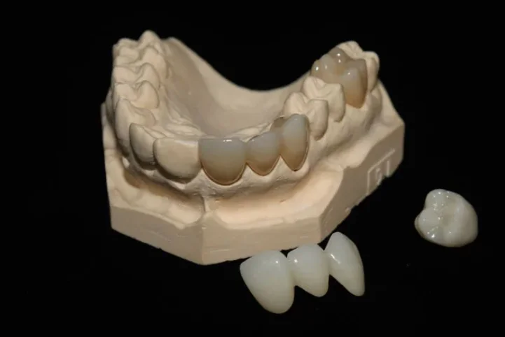 Huge Dental Denture Materials Type Dental Zirconia Disk  MHT for Dental Laboratory