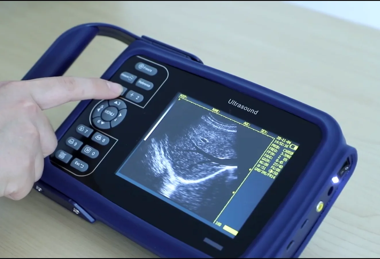 Handheld Digital Ultrasound Device Portable Ultrasound Machine