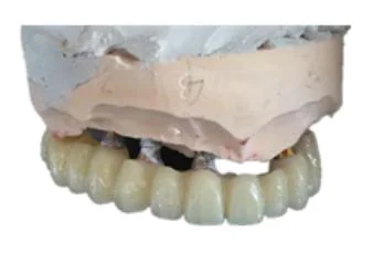 Стоматологическая лаборатория CAD/CAM Dental PMMA полностью протезный монослойный