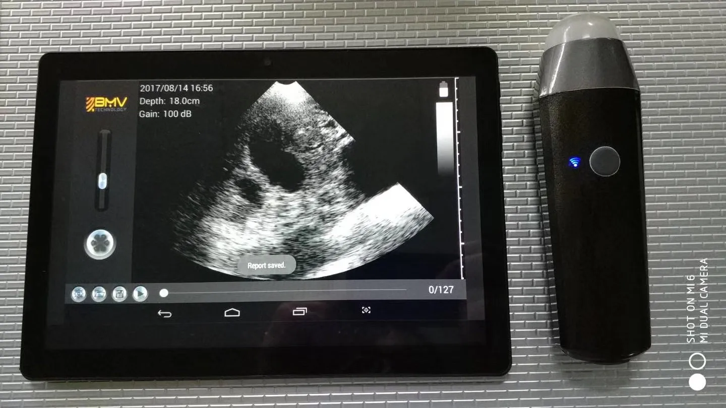 BestScan S3 portable pocket wireless bluetooth ultrasound probe echographe equipment for veterinary vet medical